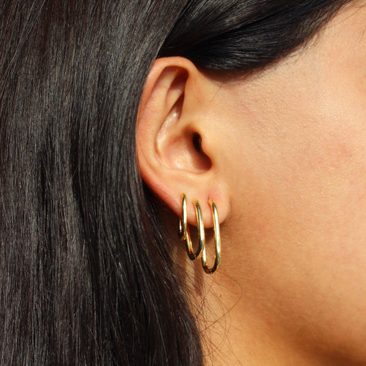 Aretes